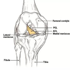 Medical illustration locating the anterior cruciate ligament in the knee.