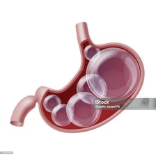 An illustration showing a visibly bloated abdomen