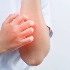 A person scratching an itchy area of skin.