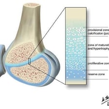 An educational illustration showing bone tissue becoming more rigid through ossification.