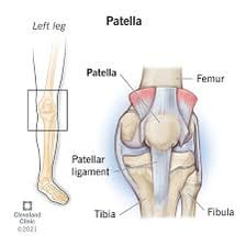 An anatomical illustration showing the patella at the front of the knee.