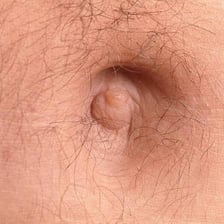 A close-up view of a human navel.
