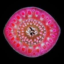 A tiny organism shown under a microscope