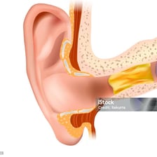 An educational ear diagram showing cerumen, or earwax