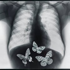 Illustration representing nervous butterflies or uneasiness in the stomach