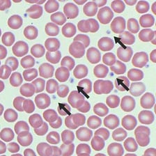 A scientific illustration of blood platelets