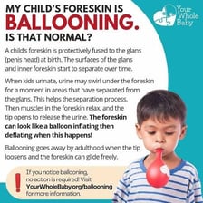 A balloon expanding as it is inflated