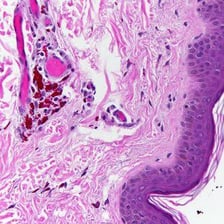 Close-up view of tattooed skin