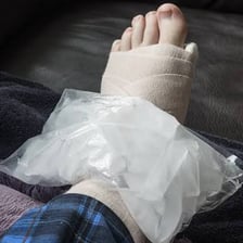 An ice pack being applied to a sprained ankle