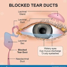 An anatomical illustration labeling the tear duct in a human eye