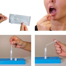 A saliva sample in a tube used for DNA testing.