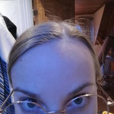 Hair strands standing straight up.