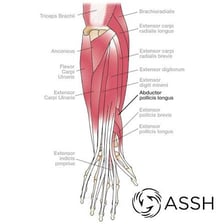 An educational illustration showing tendons in the human body.