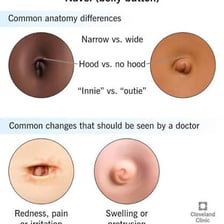 An educational illustration comparing inward and outward belly buttons