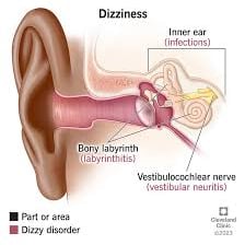 A person appearing dizzy and unsteady after spinning.