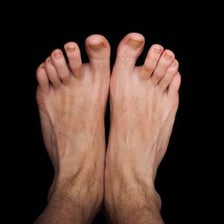 A close-up photograph showing the toes on a human foot.