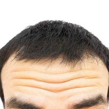 A concerned person with visible lines on the forehead