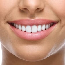 A close-up of a person smiling broadly with their teeth visible.