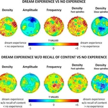 An educational illustration of REM sleep and dreaming