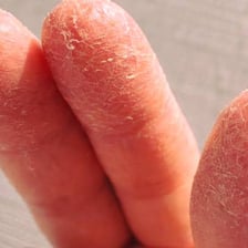 A fingertip with a small amount of lotion on it.