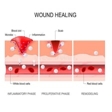 A simple medical illustration of a scab covering a healing wound