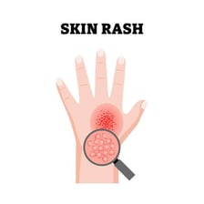 A medical illustration showing minor skin sores