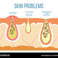 A close-up educational view of pores in human skin
