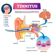 An educational illustration showing the ear canal and inner ear.