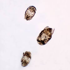 Magnified view of a tiny mite