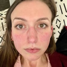 An embarrassed person with a visibly flushed face
