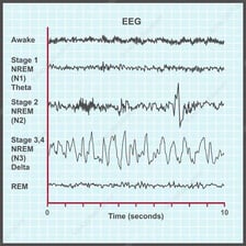 An educational EEG illustration showing delta waves during deep sleep