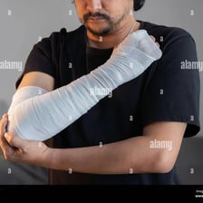 A person wrapping an arm in bandages.