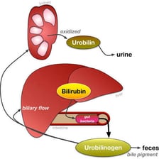 A medical illustration showing bilirubin associated with bile and the liver.