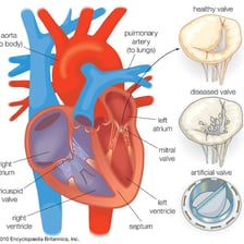 An anatomical illustration showing the valves inside a human heart.