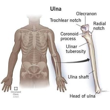 An anatomy diagram highlighting the ulna bones in the forearms.