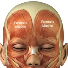 A close view showing a person’s forehead and brow area