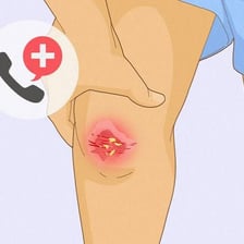 A close-up of a minor scrape on a person’s knee.