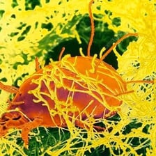 A magnified cheese mite on the surface of cheese.