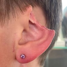 A close-up of a human ear with an earring through the earlobe
