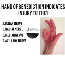 A simple diagram showing the letters of LUNAR rearranged to form ULNAR.