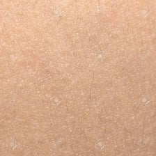 A close-up view of human skin.