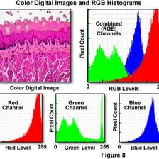 A magnified digital image showing individual square pixels in a grid