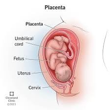 A medical illustration of a human placenta with its umbilical cord