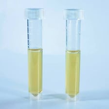 A laboratory test tube containing a visible biological culture.