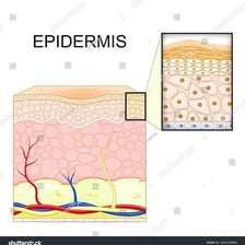 A medical illustration showing the epidermis as the outer layer of human skin.