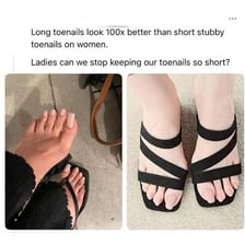 A person's toes visible through open-toe sandals.