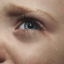 A person with tearful, misty eyes