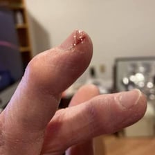 A single tiny crumb resting on a fingertip