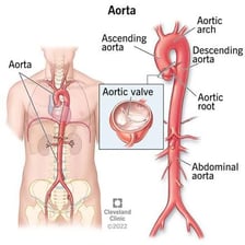 An anatomical illustration labeling the aorta on the human heart