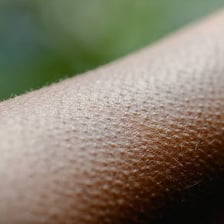 Raised goosebumps visible on a person’s skin.